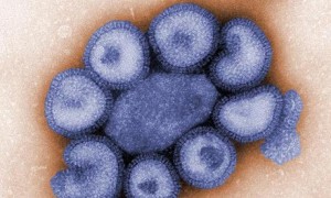 The H1N1 strain of the swine flu virus