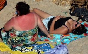 The Spanish sun is one of the main factors being blamed for a massive surge in cases of skin cancer among Brits