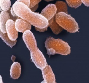 These extremophile organisms – or bacteria – were discovered 150m beneath the surface in Las Cruces mine by researchers at the Centro Superior de Investigaciones